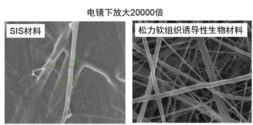 上海六家医院启动 国家创新产品复合疝修补补片上市后多中心前瞻性队列研究